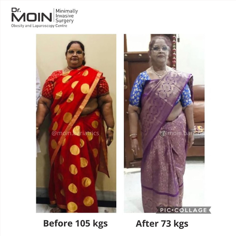 bariatric surgeon