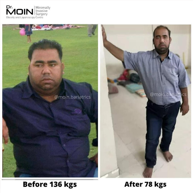 allurion weight loss