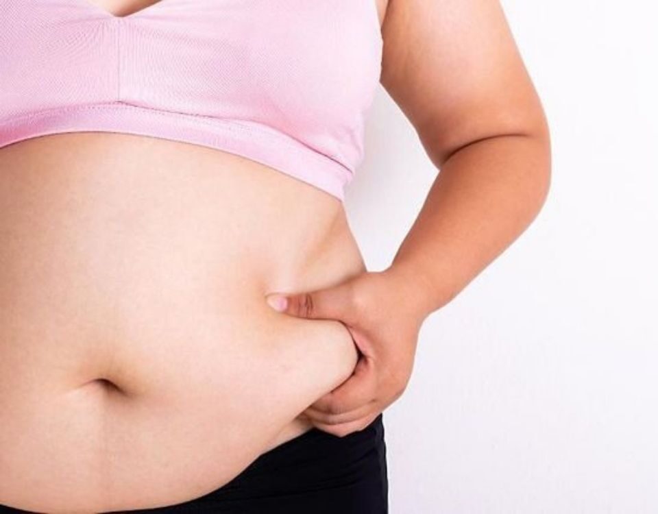 Woman Showning Her Belly Fat